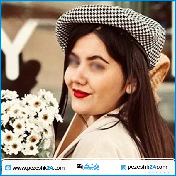 نمونه عمل زیبایی بینی دکتر معین