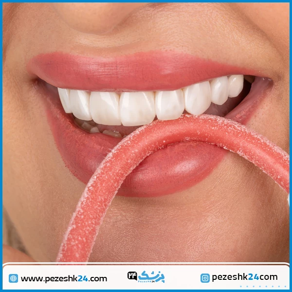 قبل و بعد کامپوزیت ونیر دکتر حقیقی