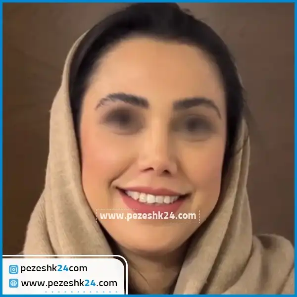 جراحی بینی دکتر کیانوش ناهید در مشهد
