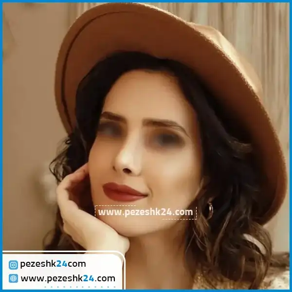 نمونه جراحی بینی دکتر جلائیان مشهد