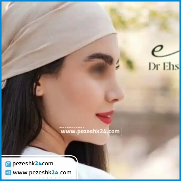نمونه عمل بینی دکتر خدیوی