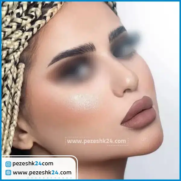 عمل بینی دکتر یگانه تیموری