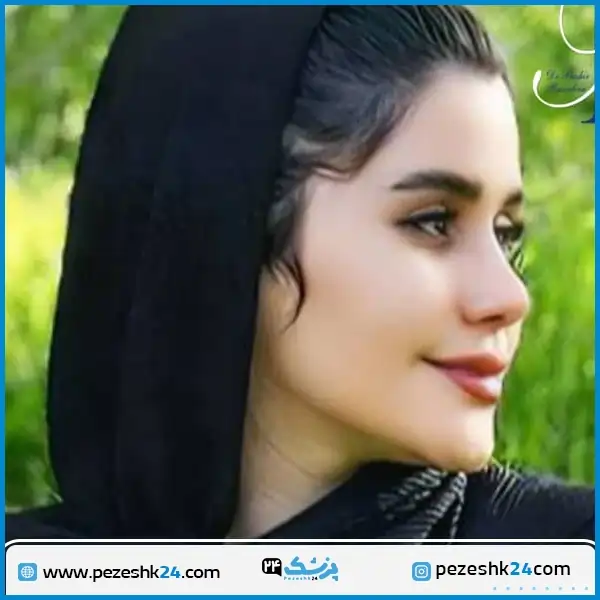 نمونه عمل بینی دکتر رسولیان مشهد