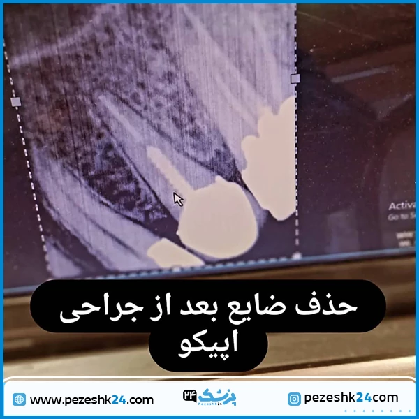 نمونه دندانپزشکی دکتر هاشمی مشهد