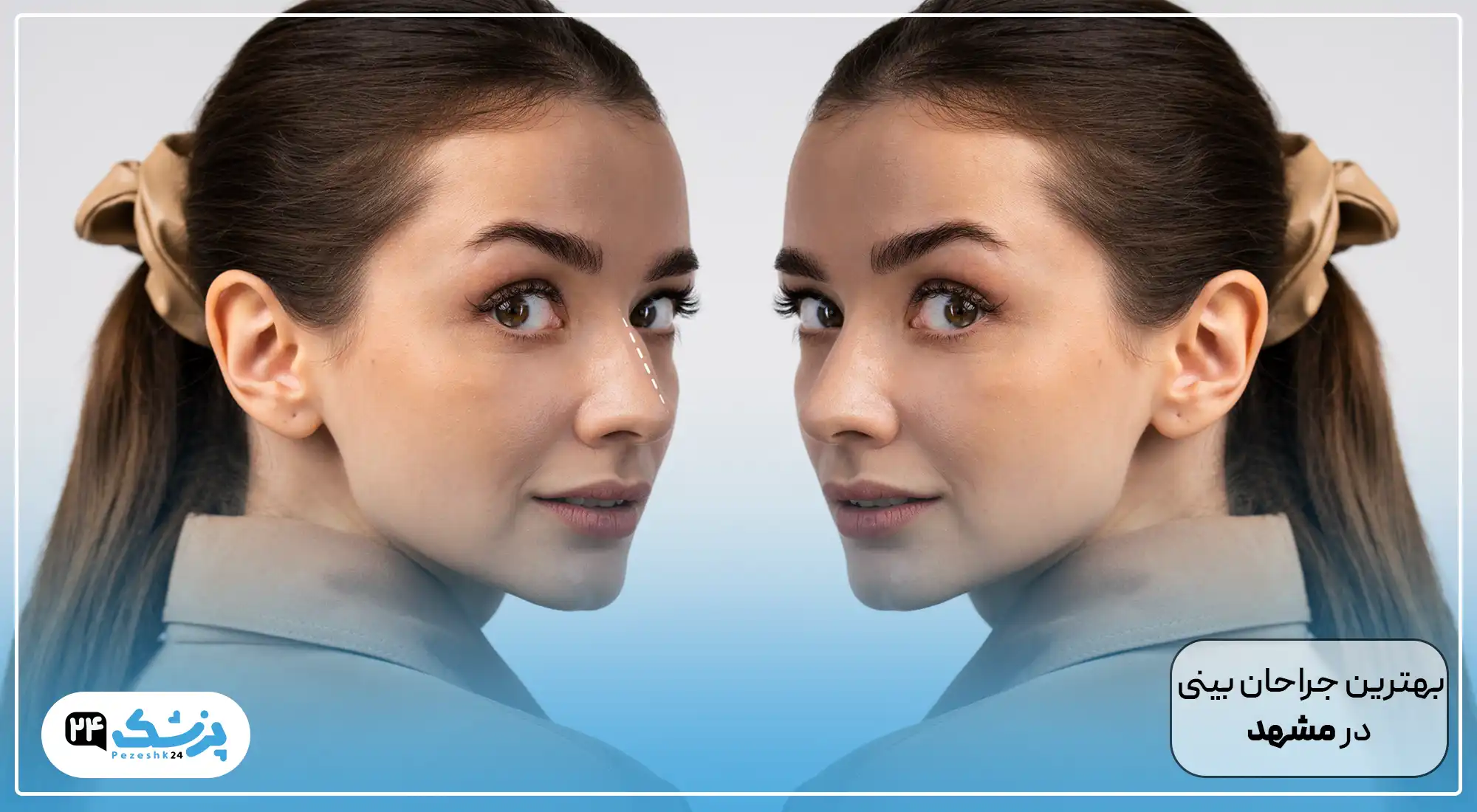 بهترین جراح بینی در مشهد