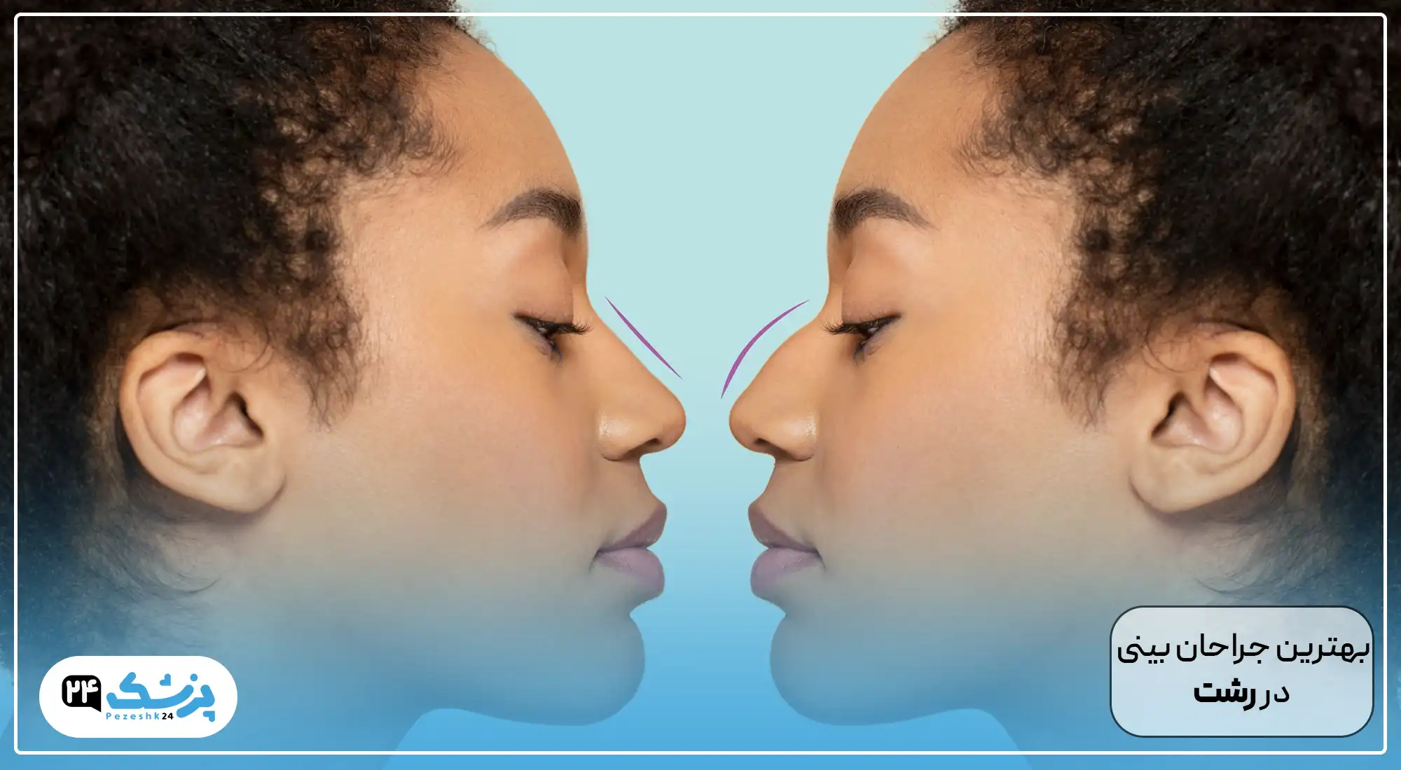 بهترین جراح بینی رشت