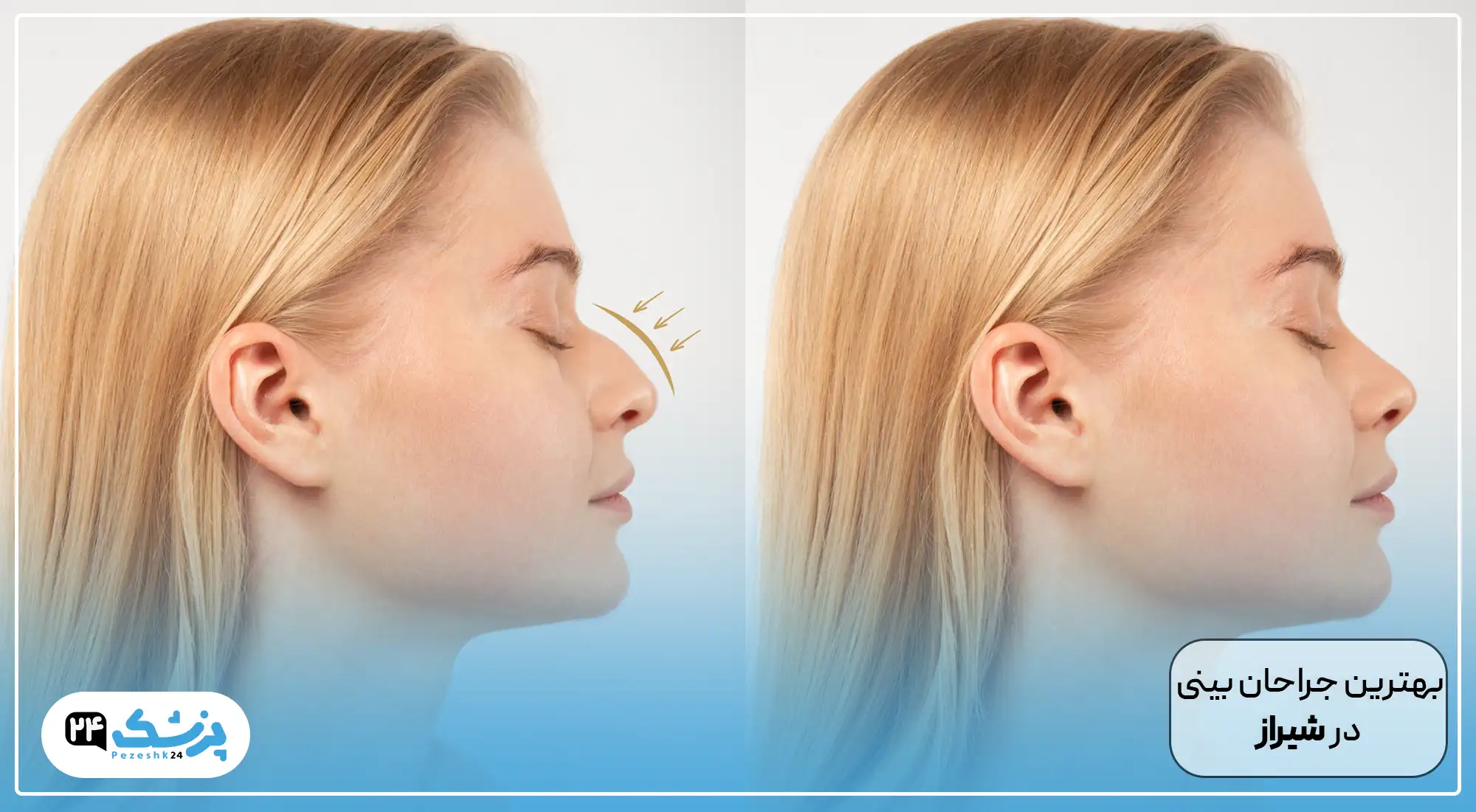 بهترین جراح بینی شیراز