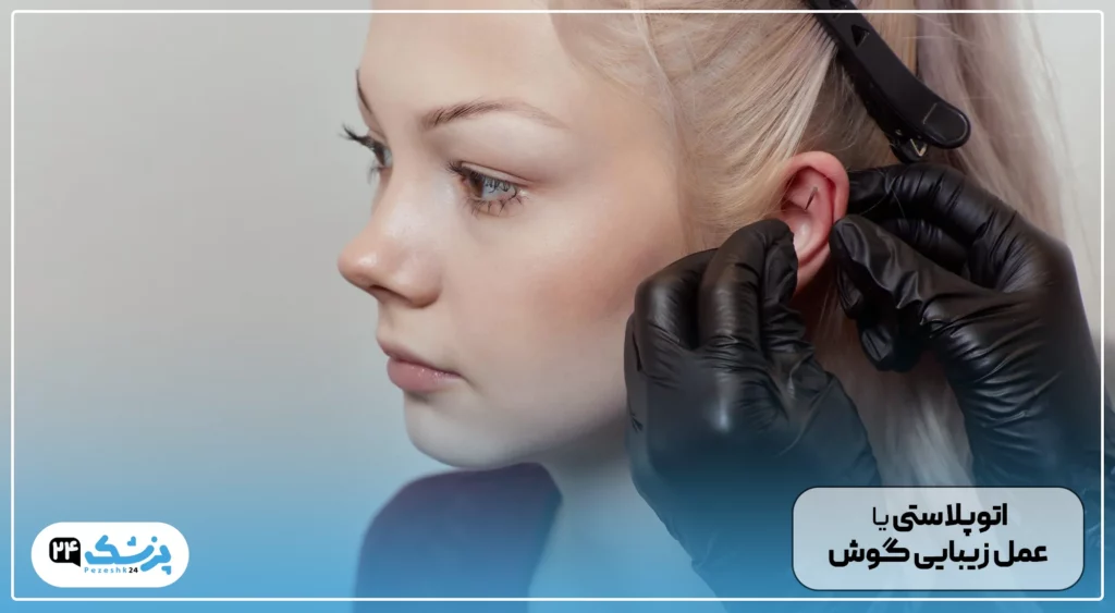 اتوپلاستی یا عمل زیبایی گوش