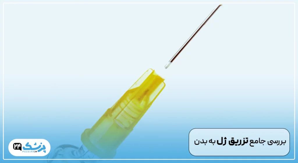 تزریق ژل