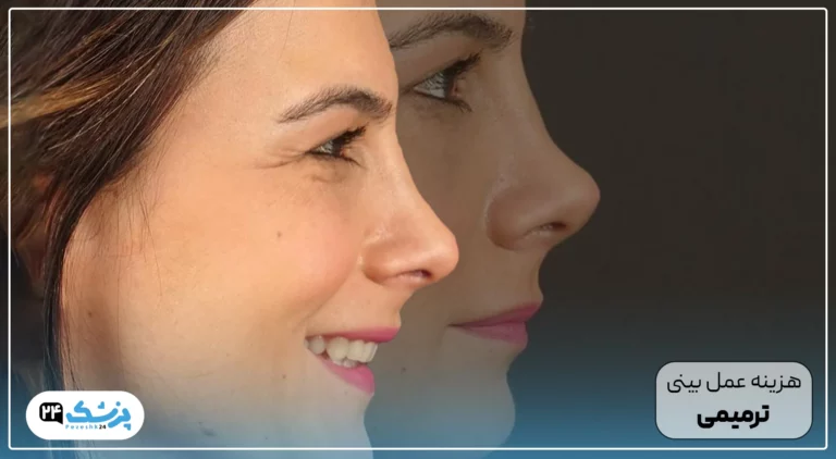 هزینه عمل بینی ترمیمی