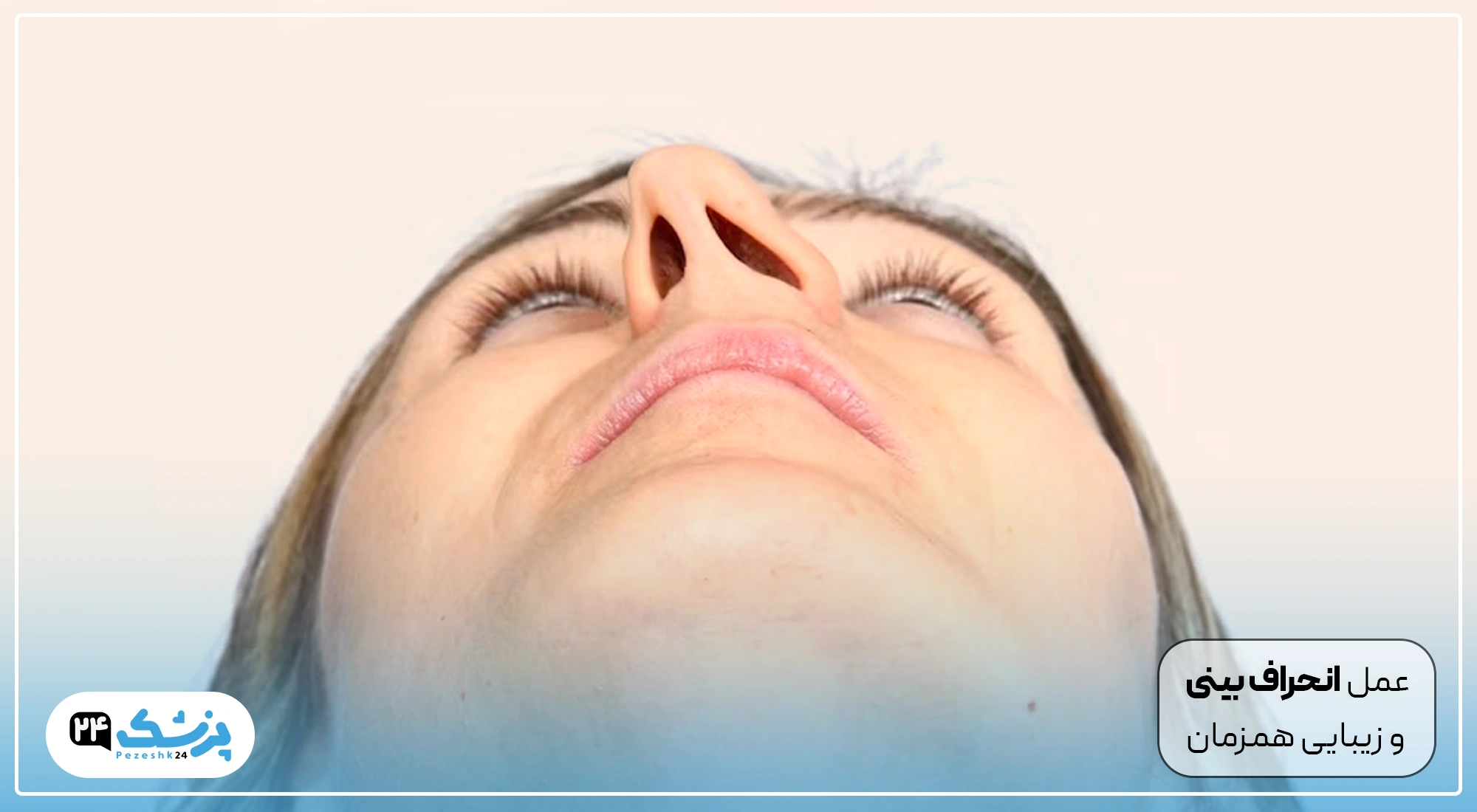 ایا عمل انحراف بینی باعث زیبایی میشود