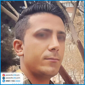 نمونه کار دکتر خدامی جراح بینی اصفهان