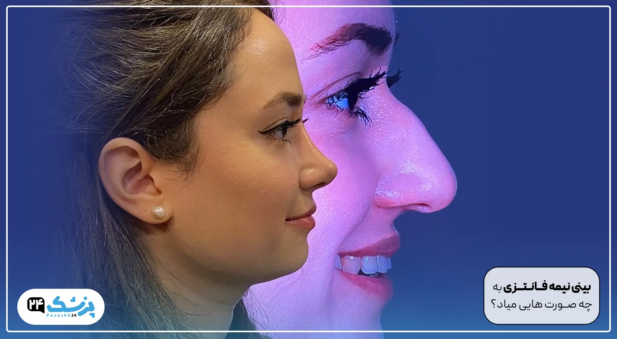 بینی نیمه فانتزی به چه صورت هایی میاد