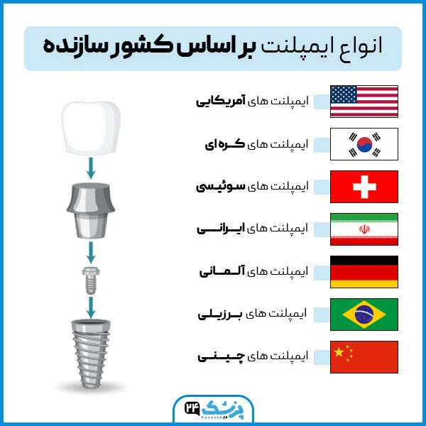 انواع ایمپلنت بر اساس کشور سازنده