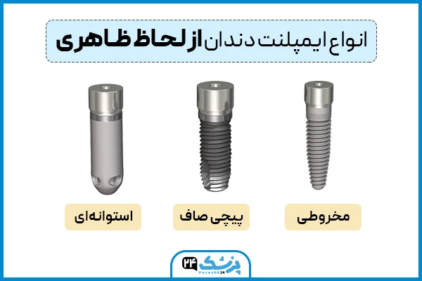 انواع ایمپلنت دندان از لحاظ ظاهری