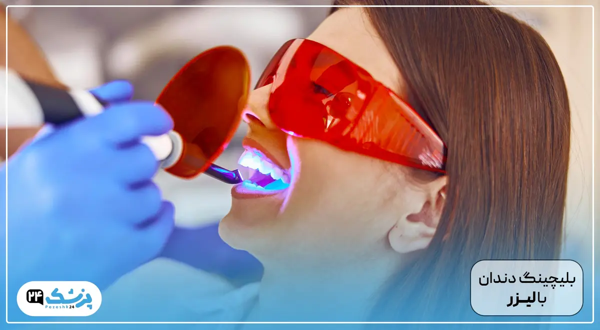 بلیچینگ دندان با لیزر