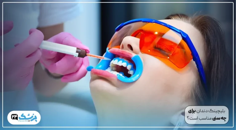 بلیچینگ دندان برای چه سنی مناسب است؟