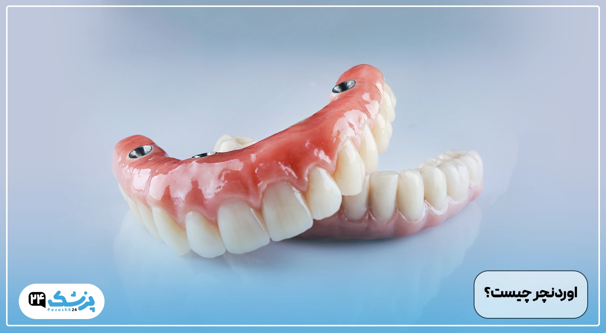 اوردنچر چیست