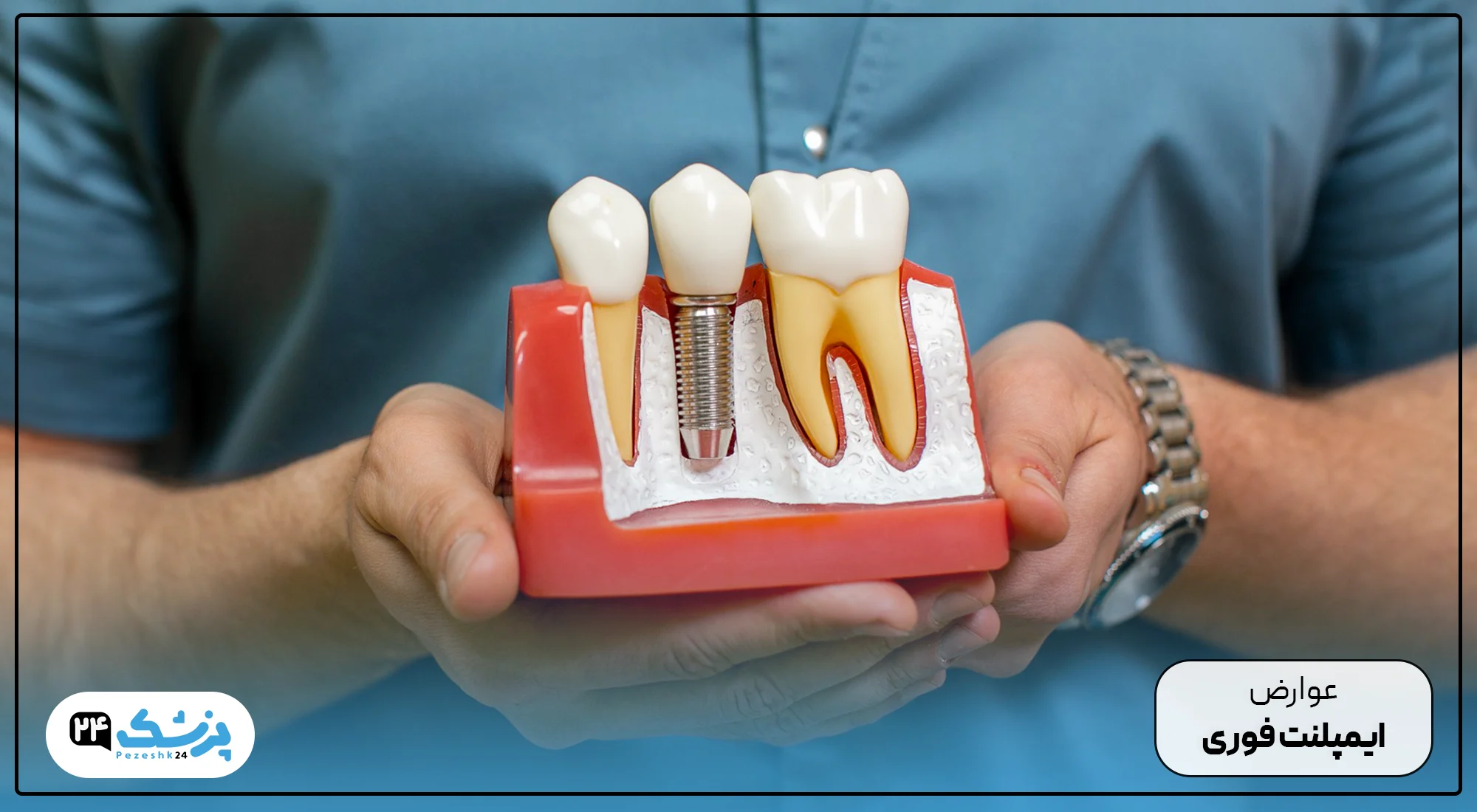 عوارض ایمپلنت فوری