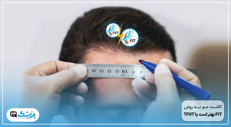 fut بهتره یا fit