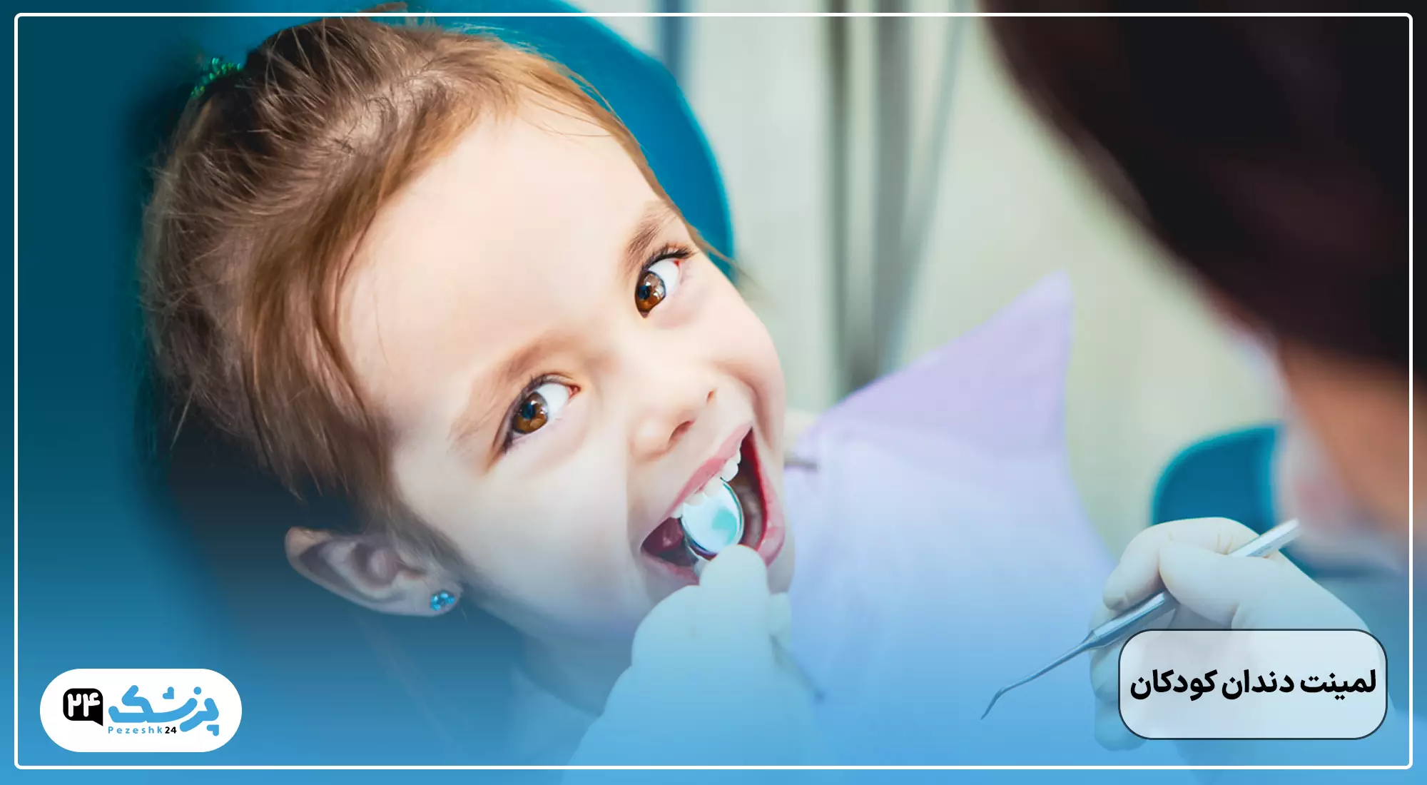 لمینت دندان کودکان