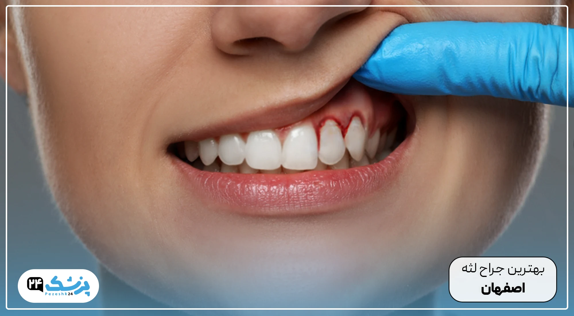 بهترین جراح لثه اصفهان