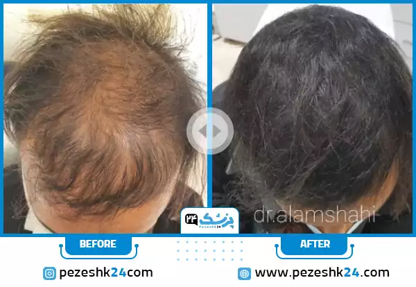 پی ار پی مو دکتر علمشاهی