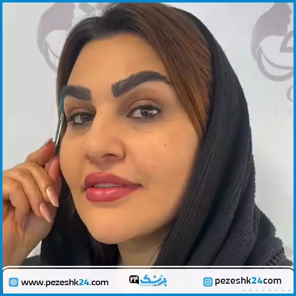نمونه جراحی کاشت ابرو کلینیک شریعتی اصفهان