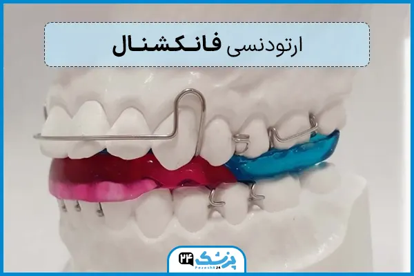 ارتودنسی فانکشنال متحرک