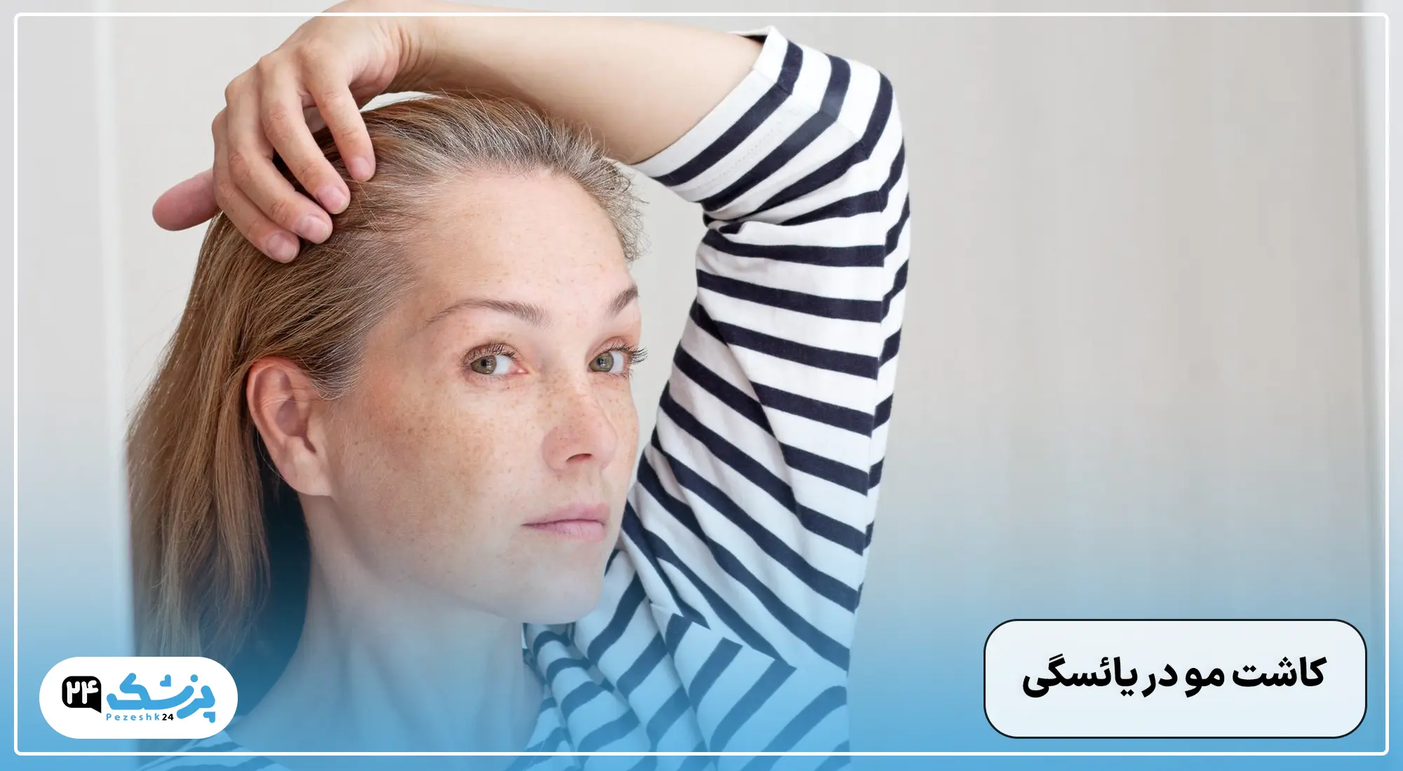 کاشت مو در یائسگی