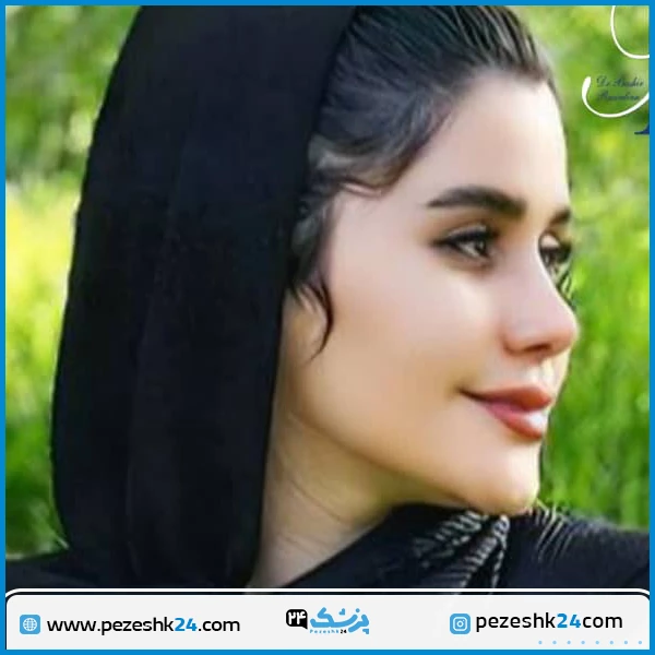 نمونه عمل بینی دکتر رسولیان مشهد