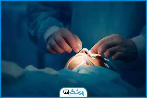 مرحله هفتم عمل بینی؛ قرار دادن اسپلینت و انتقال به ریکاوری