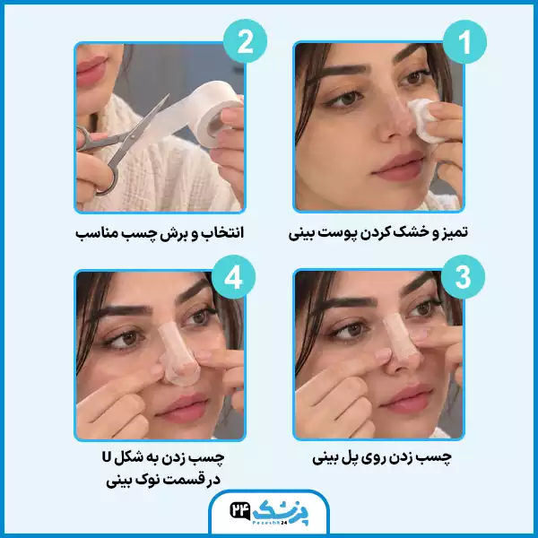 مراحل نحوه چسب زدن بینی بعد از عمل