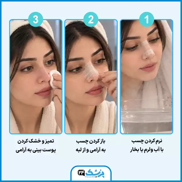 نحوه برداشتن چسب بینی بعد از عمل
