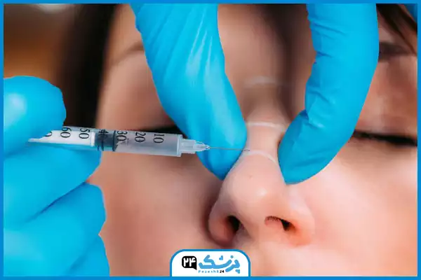 تصویر آنزیم بینی