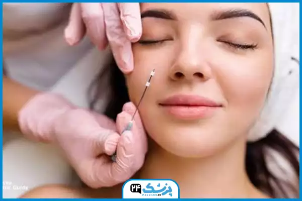تصویر لیفت بینی با نخ