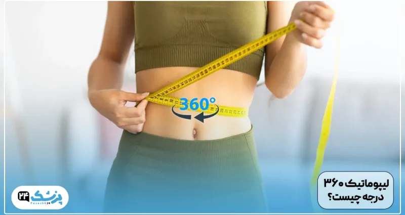 لیپوی 360 درجه چیست