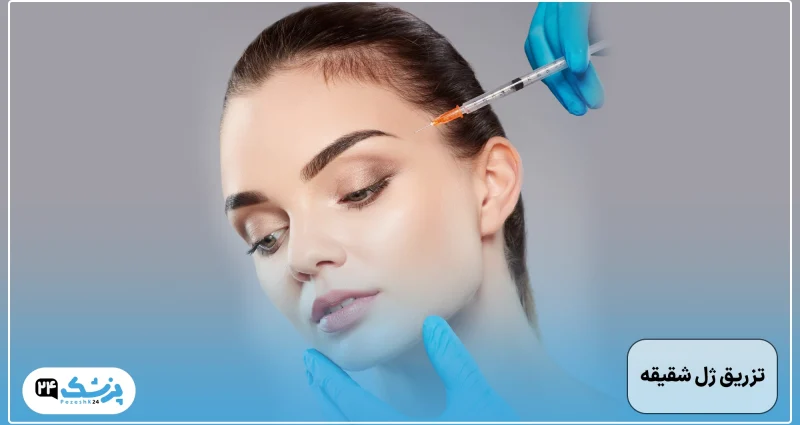 Temple gel injection