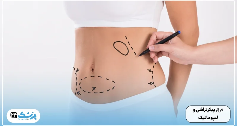 The difference between body sculpting and liposuction