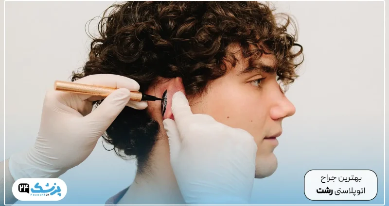 best doctor otoplasty rasht