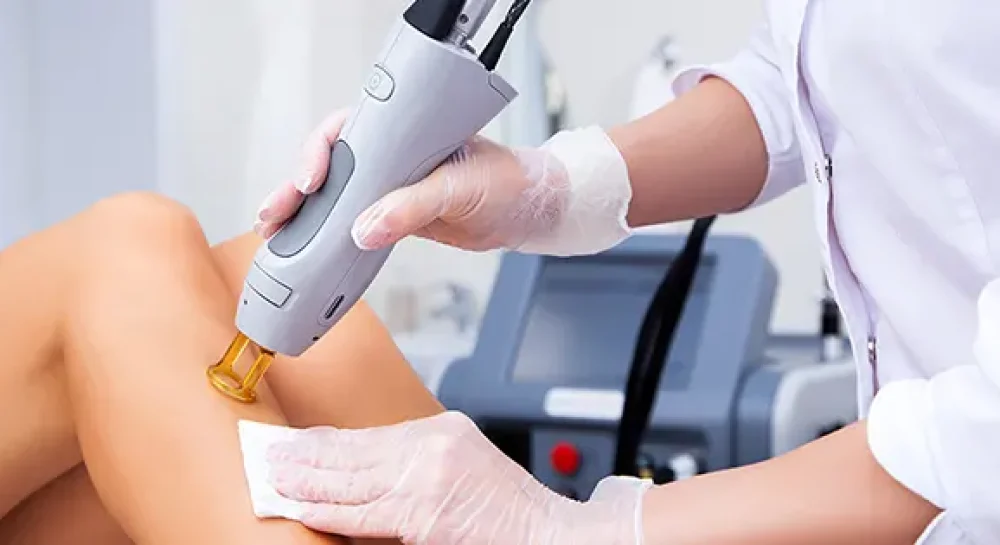 laser hair removal in shiraz