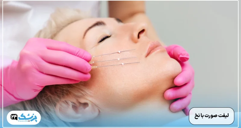 thread face lift