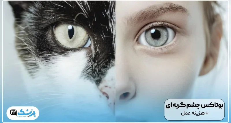 بوتاکس چشم گربه ای