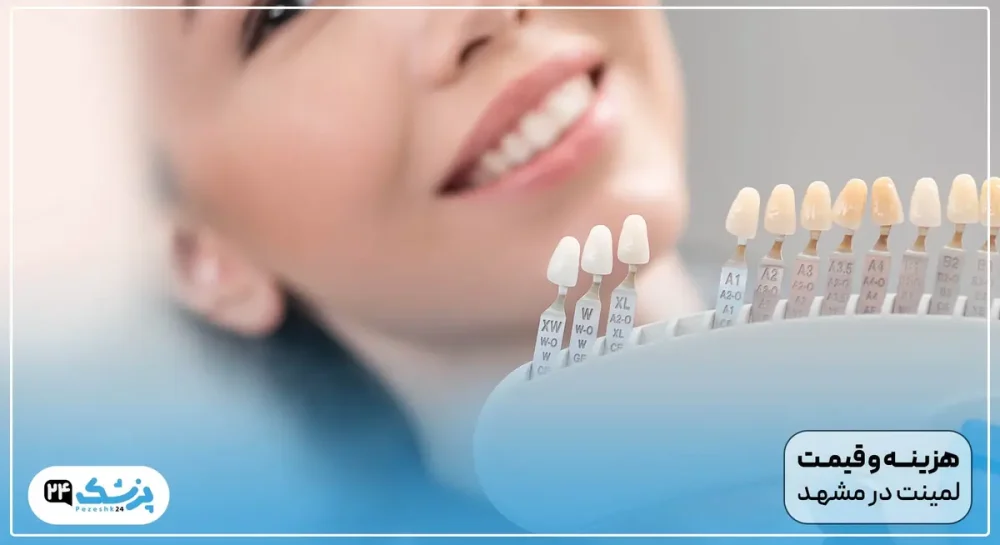 هزینه و قیمت لمینت دندان در مشهد
