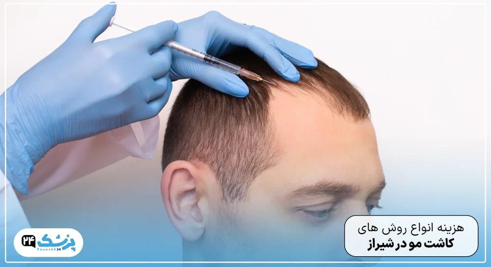 هزینه کاشت مو در شیراز