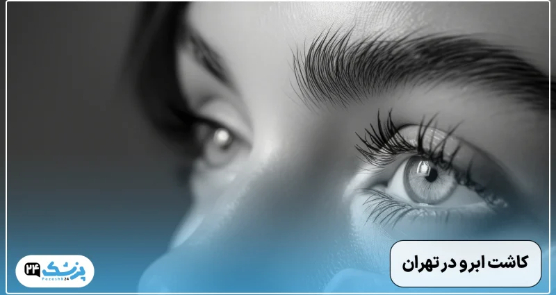 کاشت ابرو در تهران