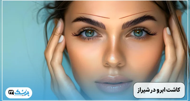 کاشت ابرو در شیراز